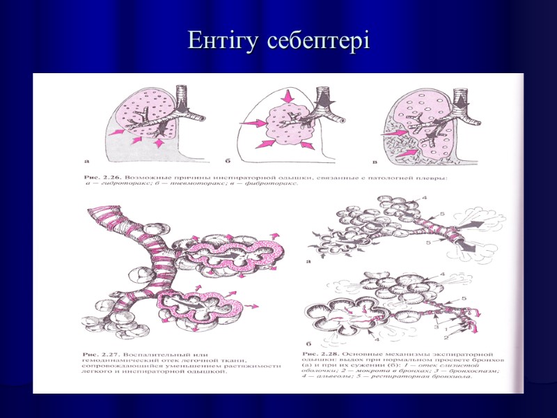Ентігу себептері